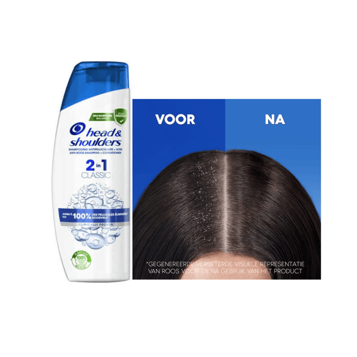 Head & Shoulders 2in1 Classic Anti-Roos Shampoo & Conditioner 480ml