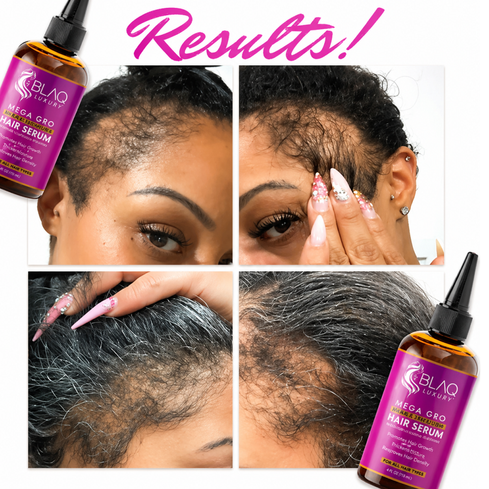 Blaq Mega Gro Hair Serum-All-Beauty and hair supply