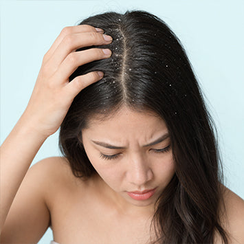Dandruff