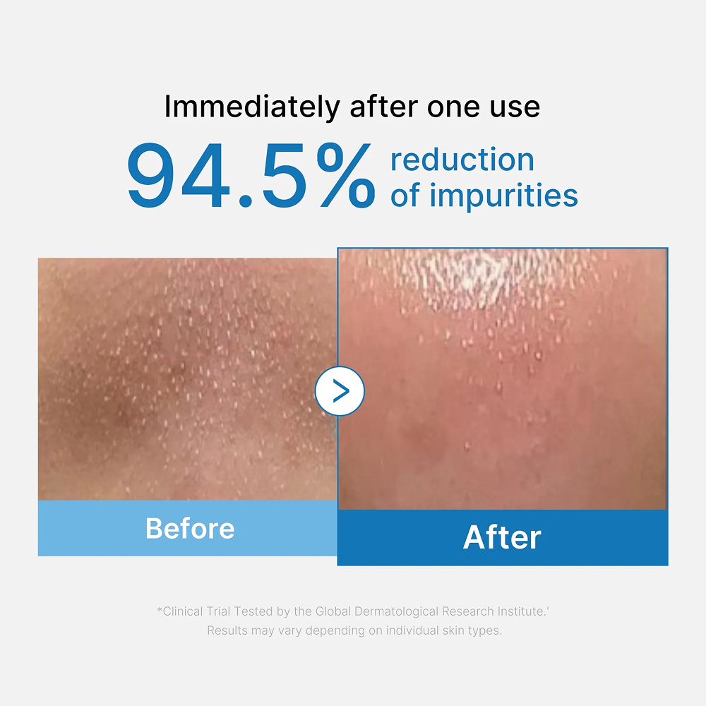 Medicube Pore Blackhead Deep Cleansing Oil 205ml-Cleansing Oil-Beauty and hair supply