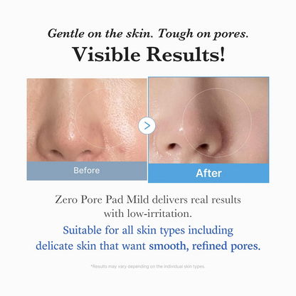 Medicube Zero Pore Pad Mild 70 Pads-Exfoliating Pads-Beauty and hair supply